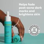 Proactiv 10% Vitamin C Serum for Dark Spots