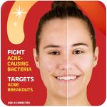 Asepxia Acne Spot Treatment Cream with Salicylic Acid