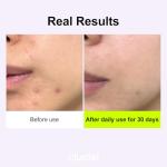 Cluciel Niacinamide Peptide Serum for Radiant Skin