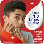 Asepxia Acne Spot Treatment Cream with Salicylic Acid