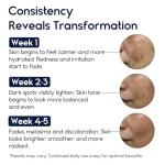 Melasma Treatment Cream for Dark Spots and Scars