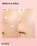 COSRX Acne Spot Drying Lotion for Blemishes