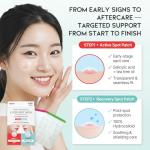 Caredermthin 2-Step Spot Patch Set - 144 Dots