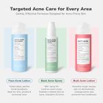 BellamiLuxx Acne Treatment Cream with Salicylic Acid