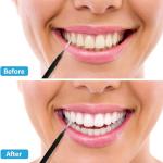 100 Interdental Brushes for Easy Dental Cleaning