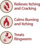 Globe Clotrimazole Antifungal Cream for Itch Relief