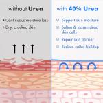 Ebanel Urea Cream for Dry Cracked Skin