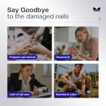 Nail Strengthener and Growth Treatment for Women