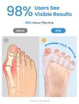 Toe Separators for Women and Men - Bunion Relief