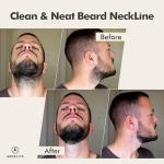 Aberlite FlexShaper 2.0 - Hands-Free Beard Guide