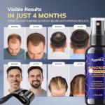 Minoxidil Hair and Beard Growth Kit with Roller