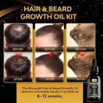 Men’s and Women’s Minoxidil Hair and Beard Growth
