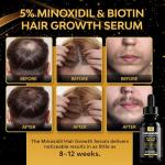 Beaueli Minoxidil Foam for Hair and Beard Growth