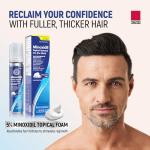 Men's Minoxidil Hair Regrowth Foam, 2.11 Oz
