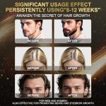 Minoxidil Foam for Hair Growth - 3 Month Supply