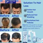 Hair Growth Serum Spray with Peptides and Caffeine