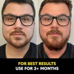 Beard Growth Serum for Thicker, Fuller Beards