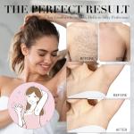 Gentle Body Hair Removal Cream for All Skin