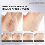 Painless IPL Laser Hair Removal Device with Cooling