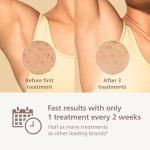 Philips Lumea 8000 IPL Hair Removal Device