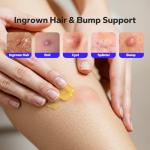 Kototo Naturals Ingrown Hair Salve and Itch Relief