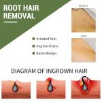 Ingrown Hair Treatment Patches for Smooth Skin