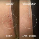 Bushbalm Ingrown Hair Exfoliating Sugar Scrub