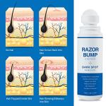 Razor Bump Stopper and Ingrown Hair Treatment