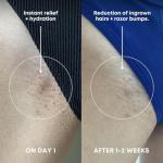 Bushbalm Ingrown Hair Exfoliating Sugar Scrub