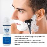 Razor Bump Stopper and Ingrown Hair Treatment