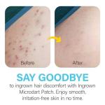 Ingrown Hair Removal Patches for Smooth Skin - 9 Pack