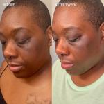 Brightening Bar with Kojic Acid and Licorice