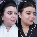 Brightening Bar with Kojic Acid and Licorice