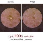 Dr. Melaxin Glow White Rice Peeling Ampoule 80ml