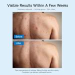 Fungal Relief Body Wash with Tea Tree Oil