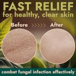 Tea Tree Oil Antifungal Body Wash with Scrubber