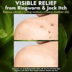 Tea Tree Oil Antifungal Body Wash with Scrubber