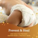 A+D Diaper Rash Ointment for Dry Skin Relief