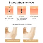 At-Home IPL Hair Removal for Smooth Skin