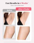 At-Home IPL Hair Removal Device for All Skin Types