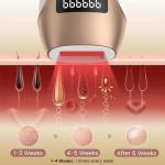 FELOOW IPL Hair Removal Device for Home Use