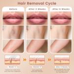 FELOOW IPL Hair Removal Device for Home Use