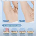 Painless IPL Laser Hair Removal Device, Rose Gold