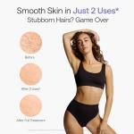 Ulike IPL Hair Removal Device for Men and Women