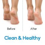 DalkomLife Foot Scrubber Feet Cleaner Washer Brush for Shower Floor Spas Massage, Slipper for Exfoliating Cleaning Foot