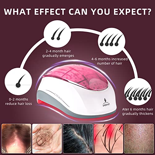 iHelmet Laser Cap for Hair Growth Treatment