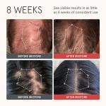 iRESTORE Biotin Conditioner for Fine, Damaged Hair