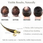 Advanced Hair Regrowth Treatment with Natural Ingredients