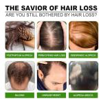 Advanced Hair Regrowth Treatment with Natural Ingredients