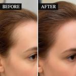 Advanced Hair Regrowth Treatment with Natural Ingredients